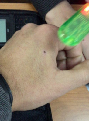 Implante de chip RFID imagen