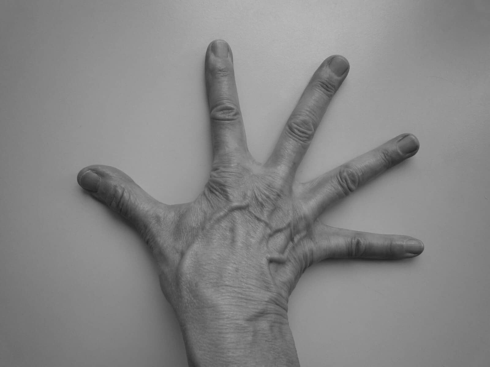 Cinco claves de la eSalud